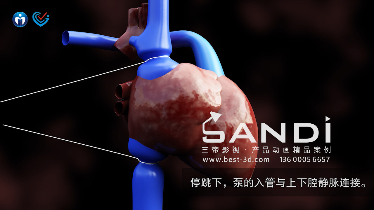 人工心脏3D动画宣传视频