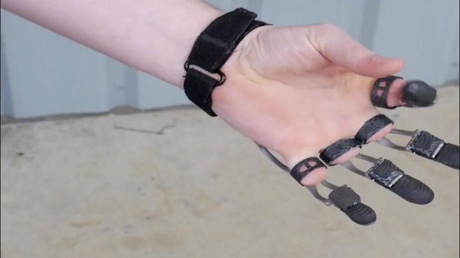 国外3D打印出仿生手指，科技含量很高，用以帮助截肢者